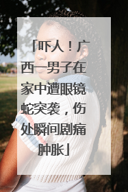 吓人！广西一男子在家中遭眼镜蛇突袭，伤处瞬间剧痛肿胀